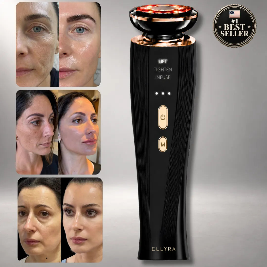 ELLYRA Skin Lift™